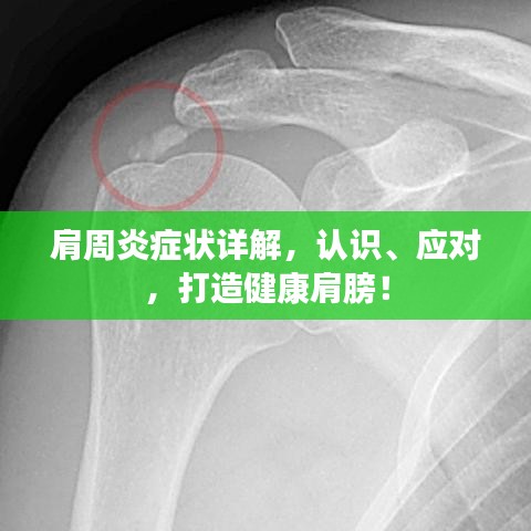 肩周炎症状详解，认识、应对，打造健康肩膀！